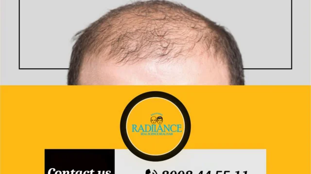 radinace 6